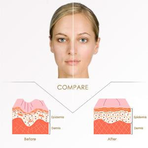 Image of Miracle V-Shaped Slimming Mask (4 Pieces/Set)