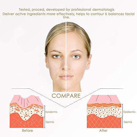 Image of Miracle V-Shaped Slimming Mask (4 Pieces/Set)